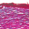 3D-printed skin closes wounds and contains hair follicle precursors