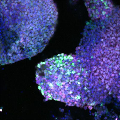 Reprogrammed fibroblast cells produce important limb cell proteins