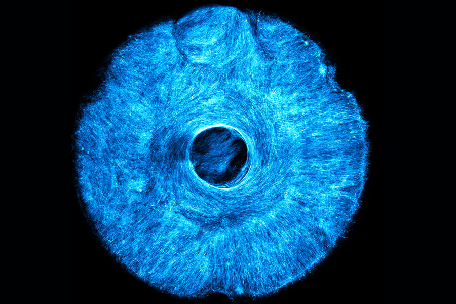 an artificial, muscle-powered structure that pulls both concentrically and radially, much like how the iris in the human eye acts to dilate and constrict the pupil