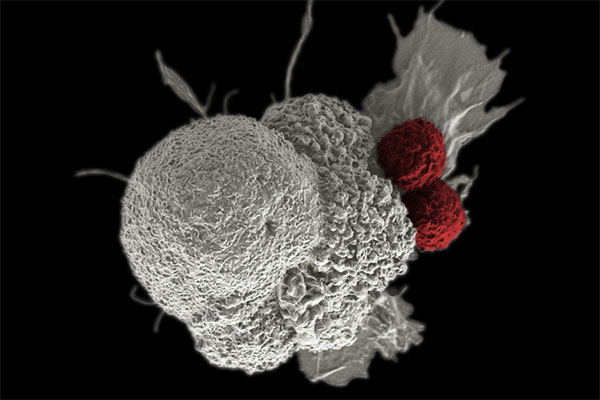 researchers are engineering immune cells like the ones in red to be able to differentiate between cancer cells and healthy cells in patients