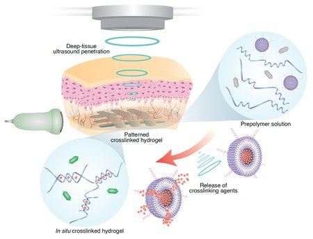 The deep tissue in vivo sound printing (DISP) platform.