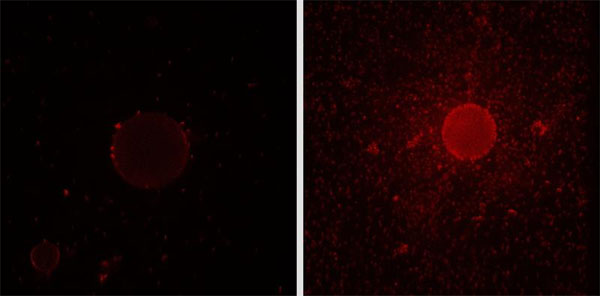 The red-marked bacteria with the gene cluster switched off were no longer able to synthesize the detergent. The bacteria were then unable to attach to the surface of oil droplets (left) the way they usually do (right)