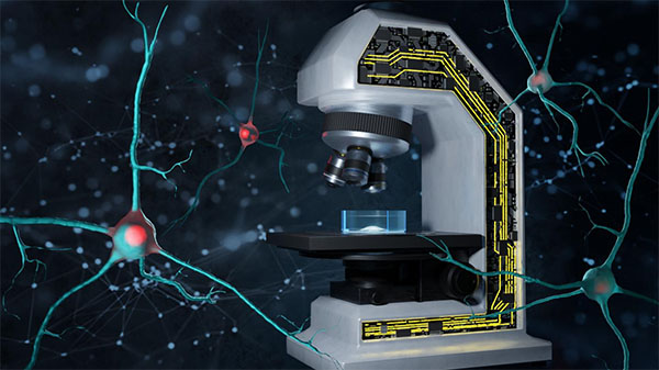 Thematic illustration of smart microscopy for detecting protein aggregation