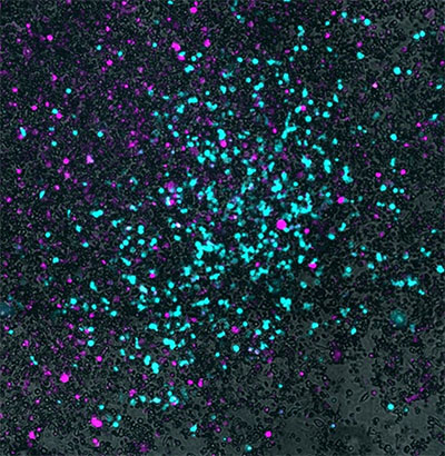 In this microscopic image, grey indicates small cell lung cancer cells, magenta shows Salmonella that have entered the cancer cells, and cyan reveals the virus spreading outward in a circular pattern from the center of the culture