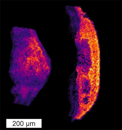 Microscopy image of skin around hydrogels loaded with a cancer chemotherapy drug one week after injection