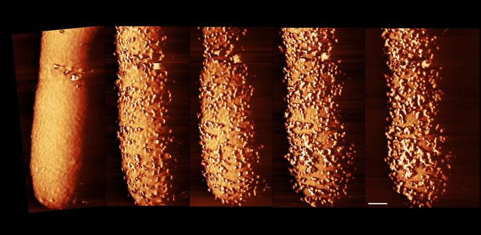 images show how antibiotic pierces bacteria’s armour