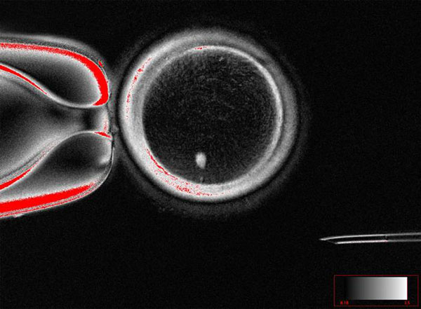 image of an oocyte with a bright image of a skin cell nucleus before fertilization