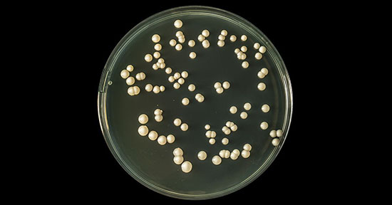 Candida albicans yeast colonies growing on a petri dish