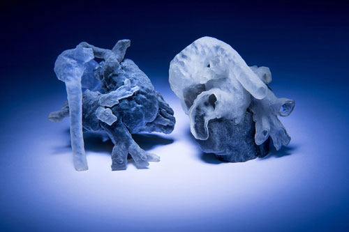 3D-printed heart models
