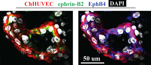 Vascular patches stained for arterial and venous markers Ephrin-B2 and EphB4