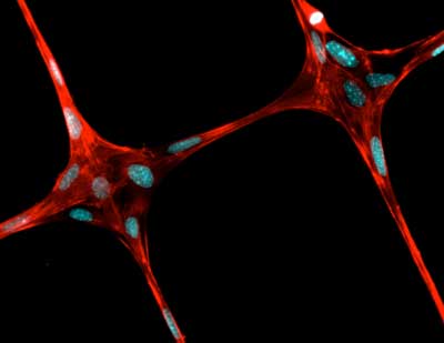 electrospinning
