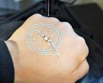3D-printing technique on skin