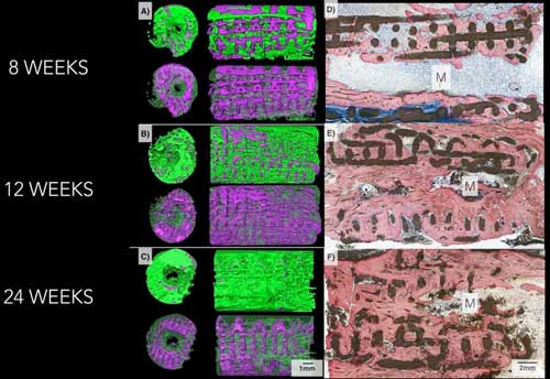 3D and Microscope Bone Images