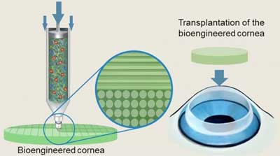 Schematic illustration of the alignment of collagen fibers within the nozzle during bioink extrusion