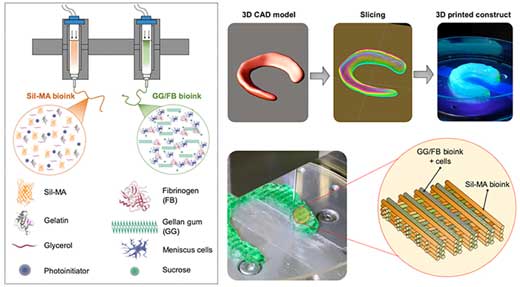 3D Bioprinted Highly Elastic Hybrid Constructs for Advanced Fibrocartilaginous Tissue Regeneration