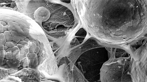 This image shows cells adhering to a titanium alloy created by cold-spray 3D printing