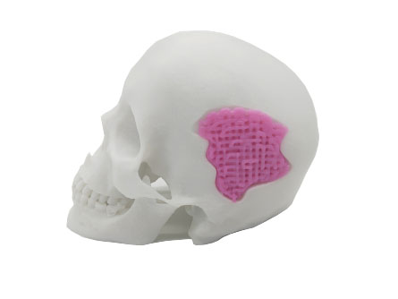 This 3D-printable bio-active glass (shown in pink) could one day be used as a bone substitute.