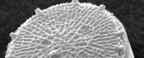 A scanning electron microscope image of the diatom Thalassiosira pseudonana