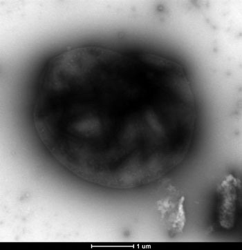 Transmission electron microscopy image of M. acetivorans