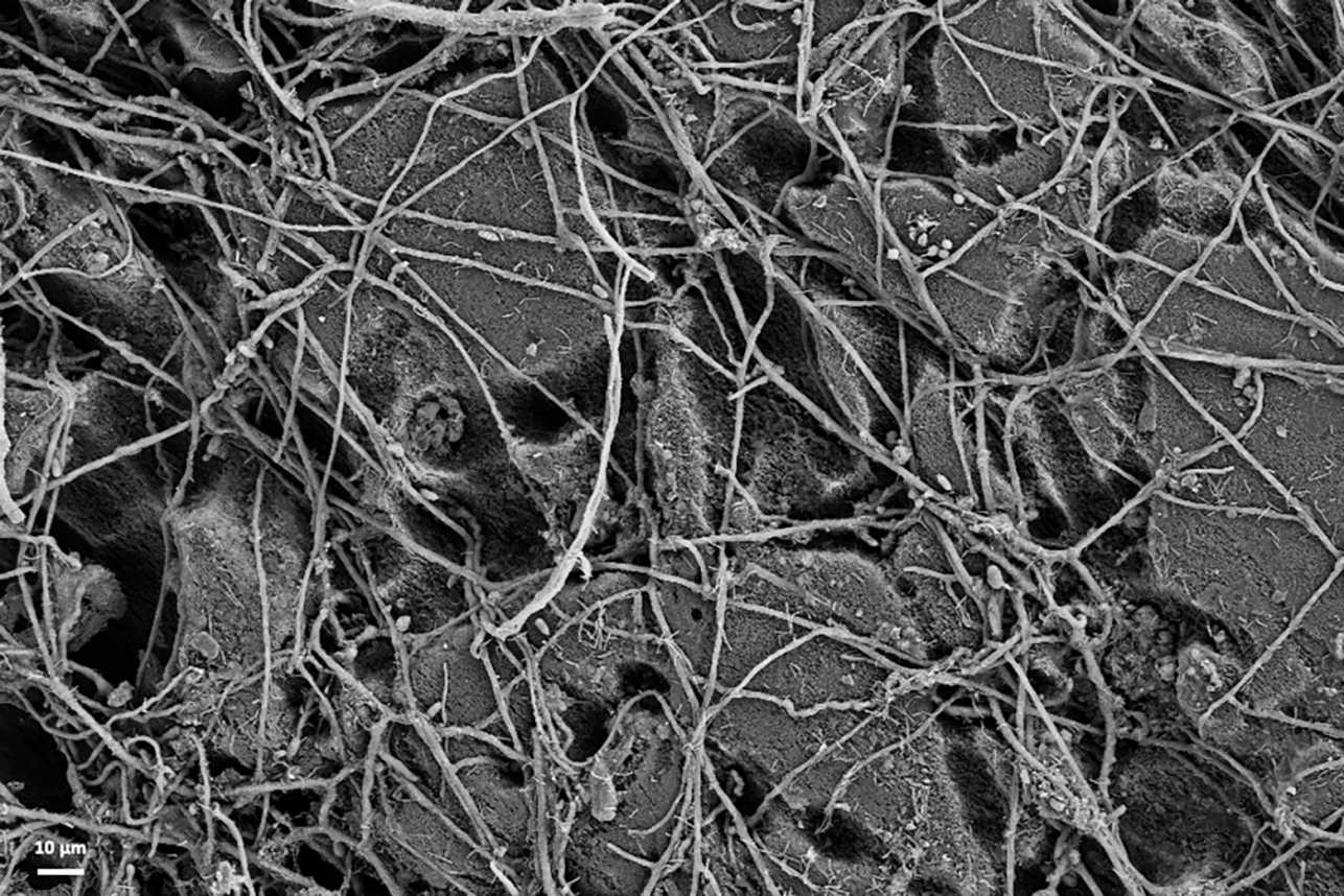 Electron microscopy image of the surface of a PBS film following incubation in a soil