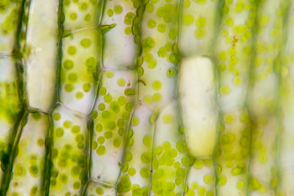 A microscopy image of plant cells showing their rigid walls, which are given structure by cellulose