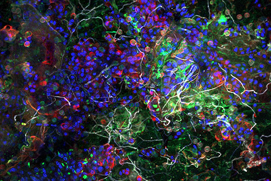Confocal laser scanning microscopy image of the plastisphere collected from plastic waste in the Pacific Ocean