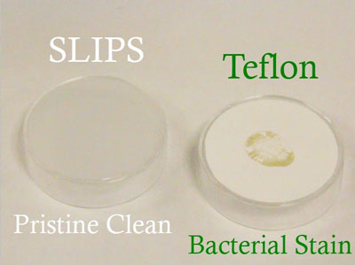 SLIPS technology for preventing biofilm 