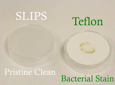 SLIPS technology for preventing biofilm