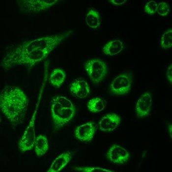 fluorescent cells