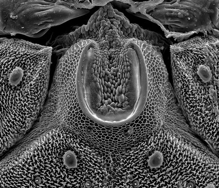 Ichneumonidae larva mouthparts