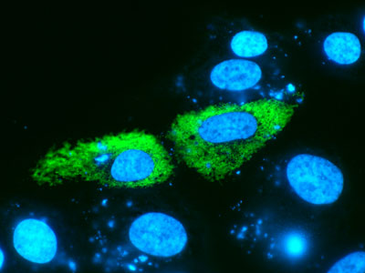 Expression of the retinoschisis protein (green) after the transfection of a cell line of retina pigment epithelium (ARPE-19) with a lipid nanoparticle-based formulation with the RS1 gene