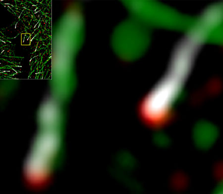 High-resolution microscopy of fluorescently labeled microtubules in cells