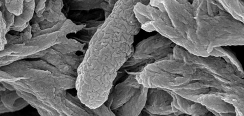 dead E. coli bacterium collected in a filter
