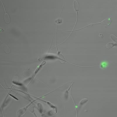 Boar Sperm Mixed with Nanoparticles that Have Been Tagged with Green Dye for Identification