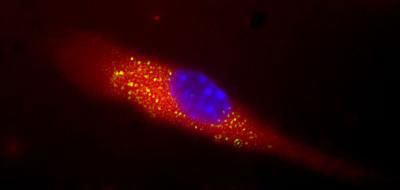 nanosponge vaccine
