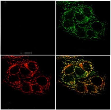 Fluorescence microscopy images of live cervical cancer cells pretreated with a sensor