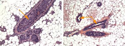 Milk ducts in mice with and without cancer cells