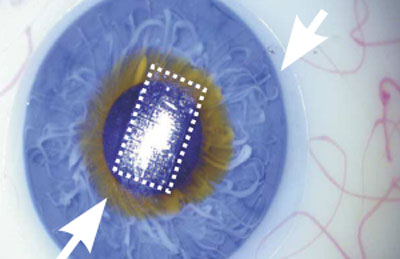 Thin-film transistor membrane transferred on an artificial eye