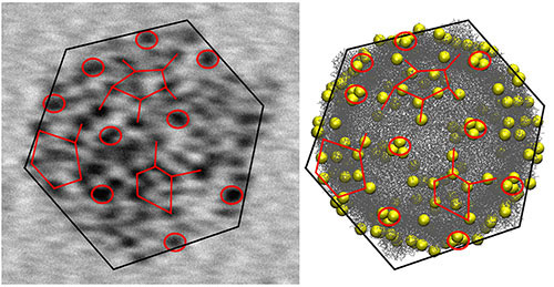  transmission electron microscopy (TEM) image of a single CVB3 virus