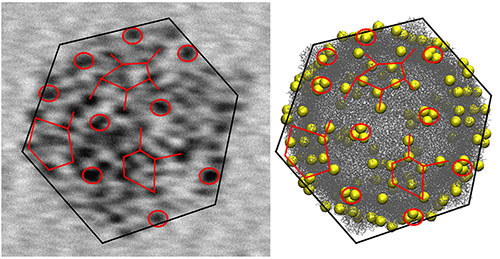 transmission electron microscopy (TEM) image of a single CVB3 virus
