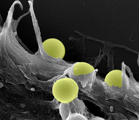 Scanning electron micrograph of silica beads (yellow) on the surface of a human fibroblast cell