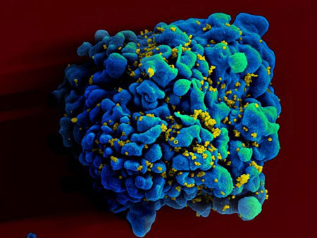 Silver nanoparticles