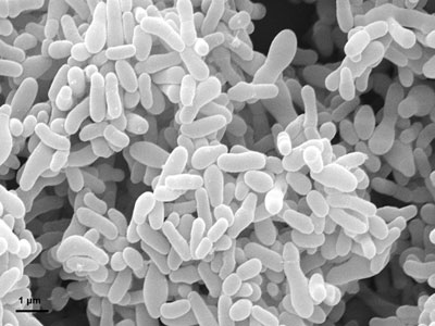 gardnerella vaginalis bacteria