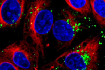 nanoparticles that can deliver short strands of RNA (green) into cells (nuclei are stained blue)