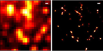 A diffraction-limited microscopy image (left) and a super-resolution microscopy image processed with rainSTORM (right) of vesicles labelled with fluorescent Epidermal Growth Factor