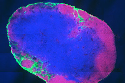 lymph node with vaccine