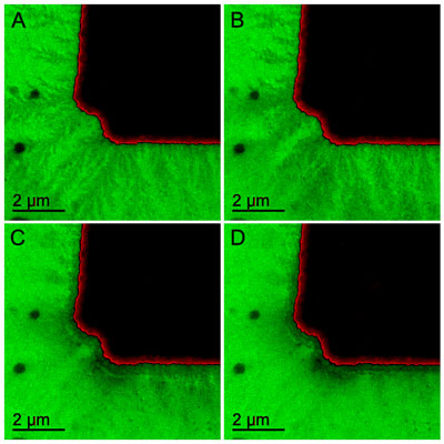 snowflake-like growth of the solid electrolyte interphase from a working battery electrode