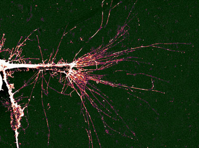 a PC12 cell growing onto a randomly textures surface