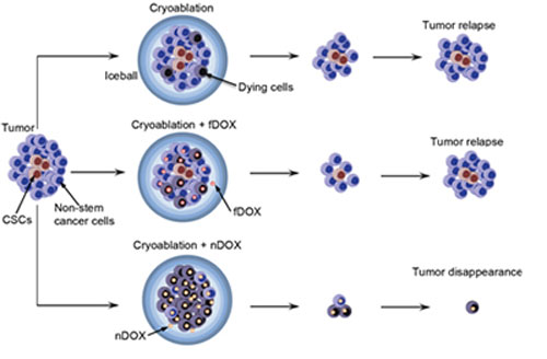 A schematic illustration of the resistance of cancer stem-like cells (CSCs) to cryoablation alone and its combination with free doxorubicin (fDOX) and nanoparticle-encapsulated doxorubicin