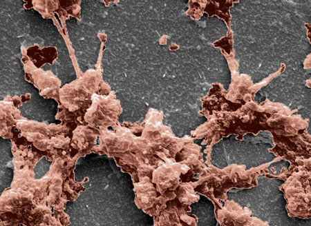 Clumping blood platelets, seen in an electron microscope image